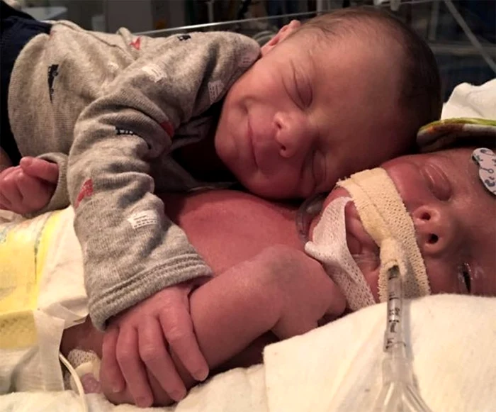 
    Hawk s-a născut cu o boală gravă (foto: Facebook)  