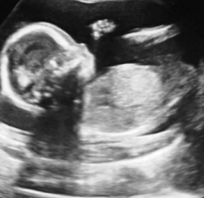 
    Vedeta a publicat chiar și o dovadă a așa-zisei sarciniFoto: arhivă personală  