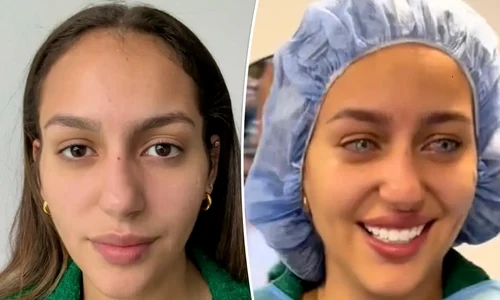 Model brazilian care și a schimbat culoarea ochilor Colaj TikTok