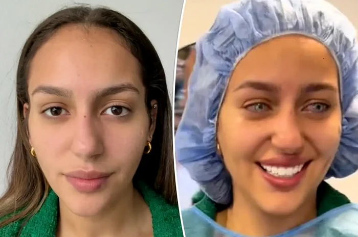 Model brazilian care și a schimbat culoarea ochilor Colaj TikTok