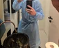 Nicu Grigore și-a făcut transplant de păr. foto: arhivă personală
