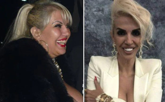 Raluca Bădulescu are acum dinți albi ca perlele, iar zâmbetul de odinioară este de domeniul trecutului