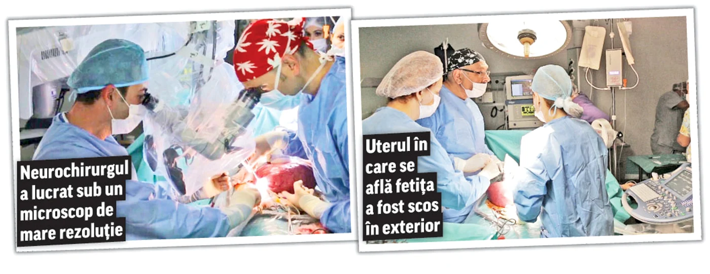 
    Medicii de la «Regina Maria» i-au făcut o intervenţie unei fetiţe de doar 1.250 de grame  