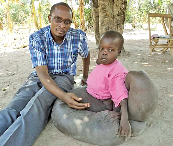 Bietul Vincent suferă de o boală căreia medicii nu îi găsesc leac