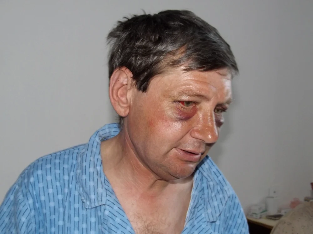 
    Cristinel Drondu va sta o săptămână în spitalFoto: "Adevărul"  
