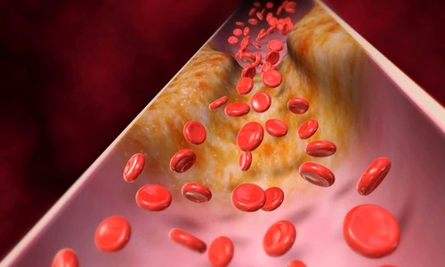 1 69118 original jpg jpeg