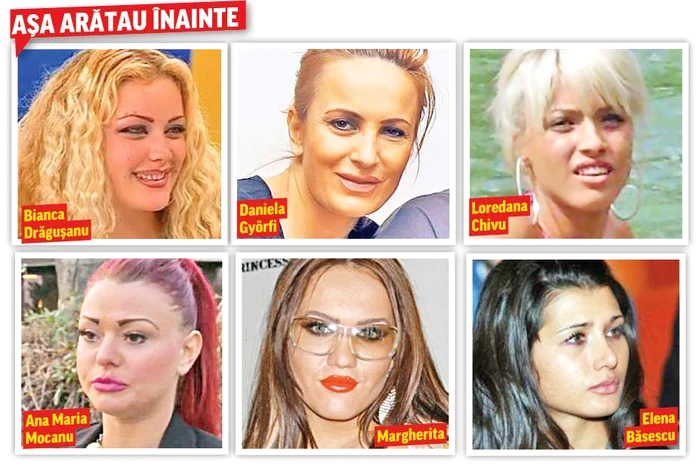 
    Vedetele noastre au exagerat cu operaţiile estetice şi au ajuns să arate ca nişte păpuşi cu buze umflate şi sprâncene de vrăjitoare  