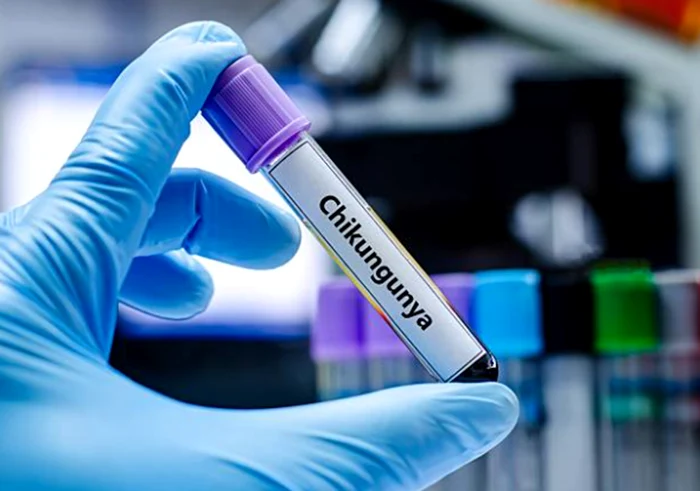 Virusul Chikungunya depistat în România. Foto: IStock