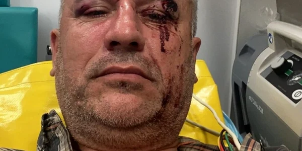 Activistul de mediu Tiberiu Bosutar la spital FOTO via newsbucovina.ro