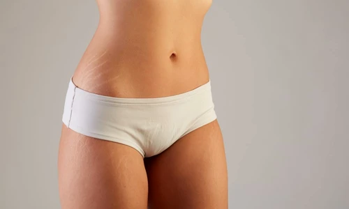 1 75080 original jpg jpeg