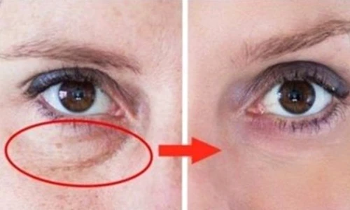 1 pungi sub ochi jpg jpeg