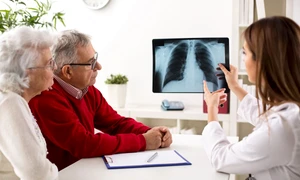 cancer pulmonar jpg
