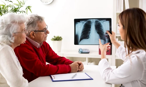 cancer pulmonar jpg