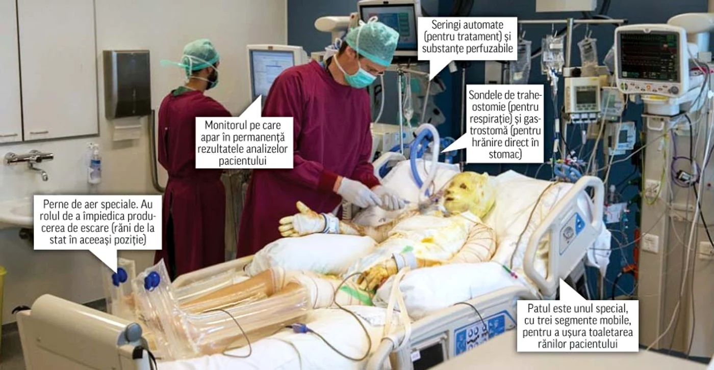 
    Suprafeţele roz  reprezintă tendoanele  care au putut fi salvate  