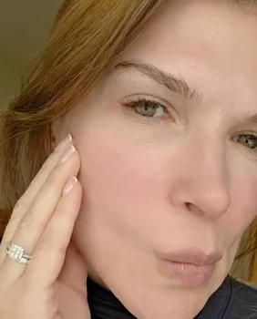 Monica Bîrlădeanu, înainte de procedură / Foto: Instagram