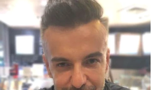 razvan ciobanu operatie estetica jpeg
