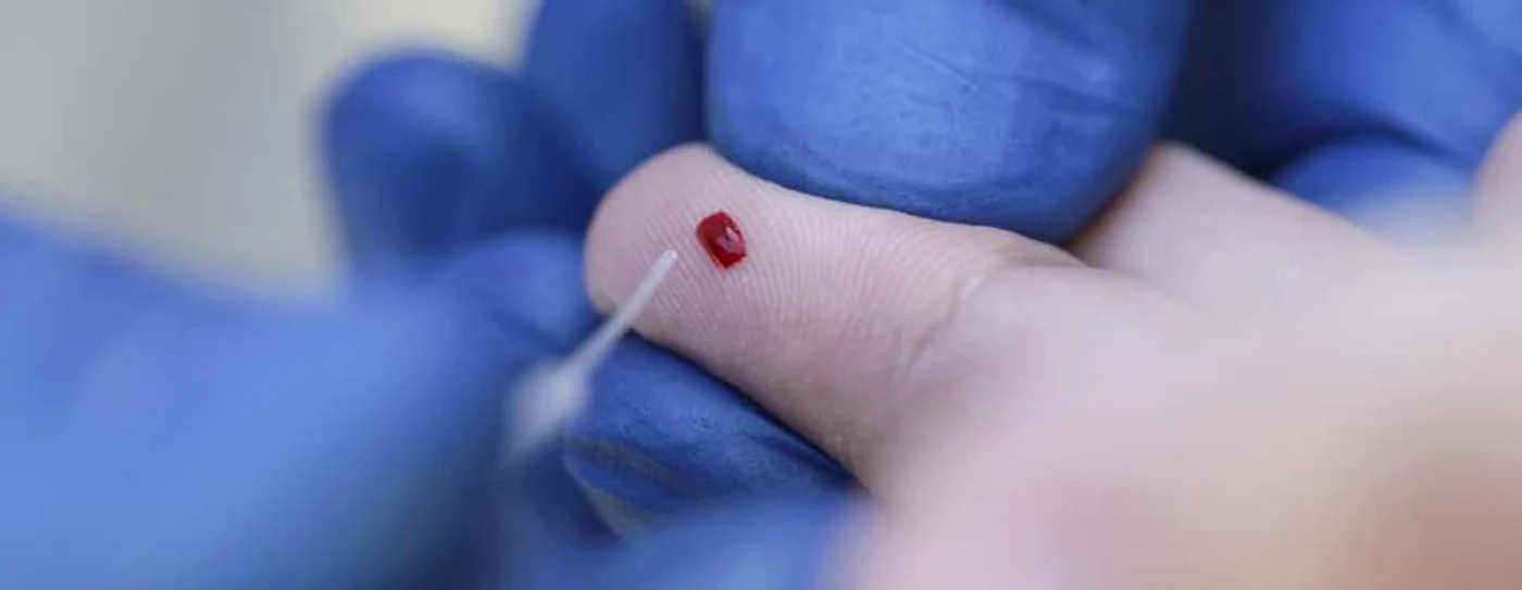 Teste rapide pe bază de anticorpi PS1 coronavirus covid 19 FOTO Inquam Photos / Octav Ganea