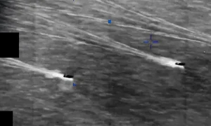 Pentagon releases unidentified aerial phenomena video   video  a1ee51dc a576 482c a81f 1387e8e42fd6 2 0 720h mp4 thumbnail png