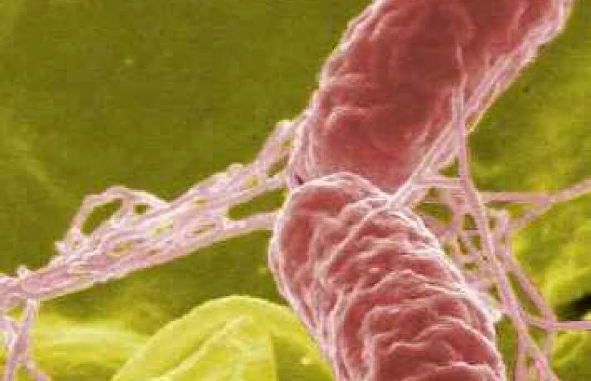 Salmoneloza este o boală provocată de bacteria salmonela