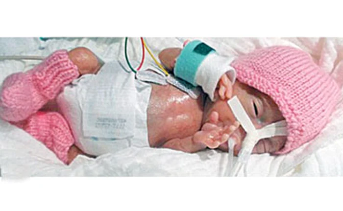 
    A fost supusă multă vreme unor tratamente speciale  