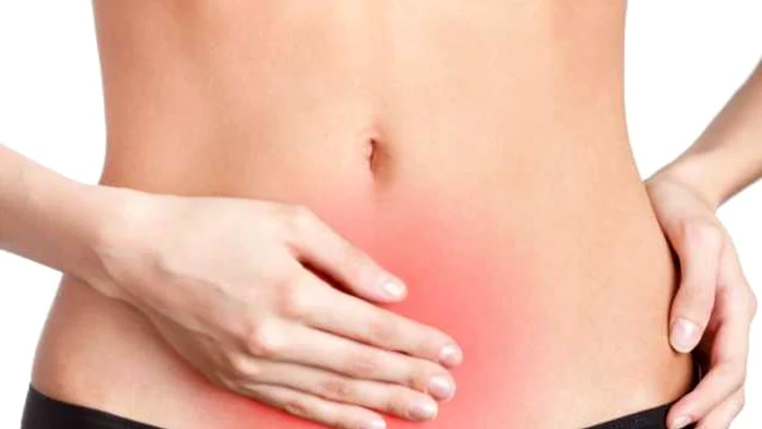 Fiona Murphy avea vârsta de 25 de ani când a fost diagnosticată cu cancer ovarian.