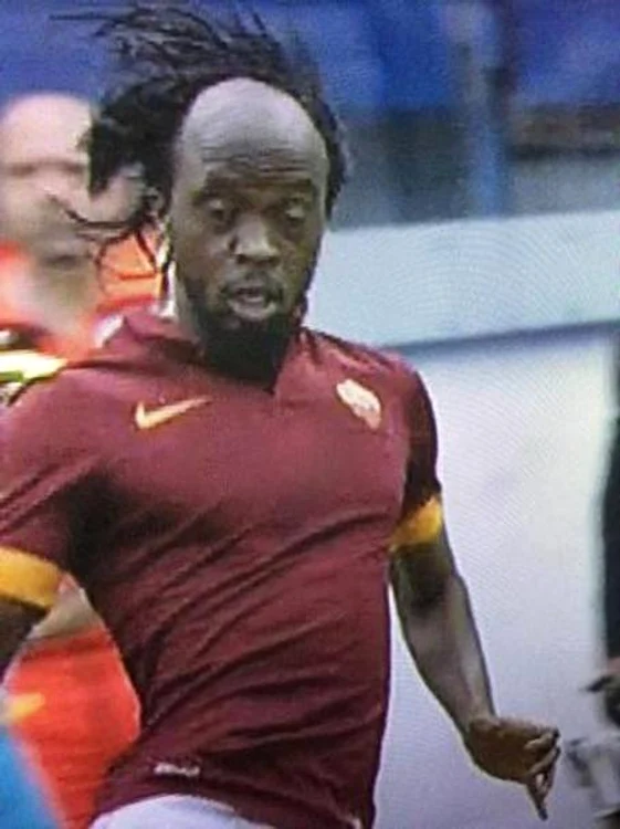 Gervinho, fără bentiţă