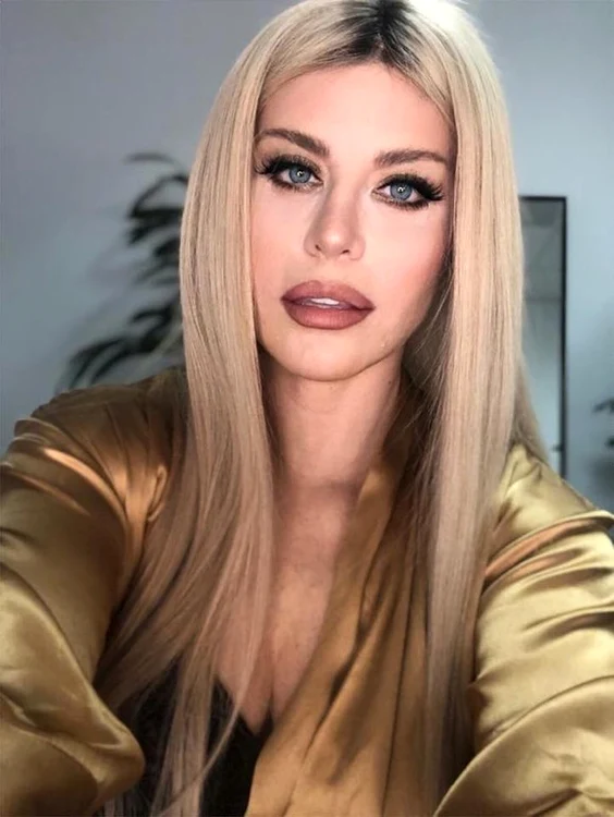 Loredana Groza a fost acuzată că trece prea des pragul medicului estetician 