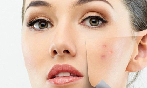 1 73641 original jpg jpeg