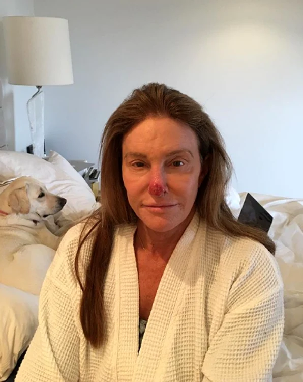 Caitlyn Jenner 123 png