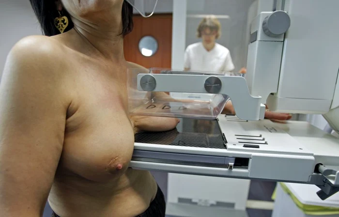 Examinarea radiologică a sânului prin mamografie