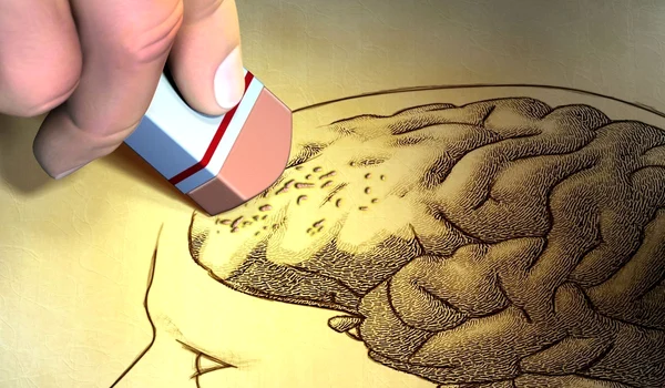 A apărut un nou tip de demenţă Cum se manifesta boala Late jpeg