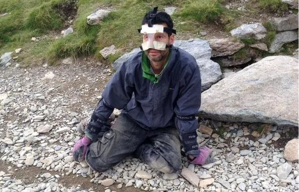Şi-a julit nasul, îl dor cumplit genunchii şi picioarele