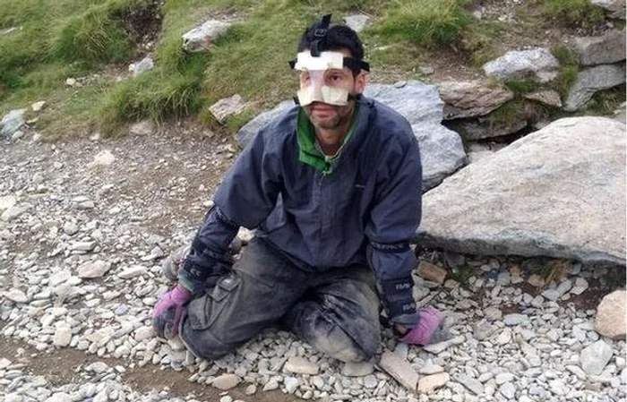 Şi-a julit nasul, îl dor cumplit genunchii şi picioarele