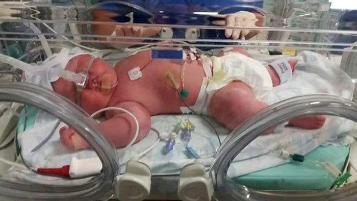 Thomas era atât de mare că a avut nevoie de un incubator special