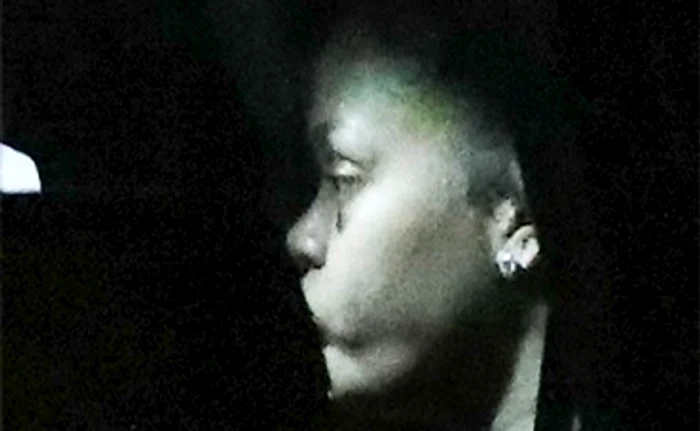 Are un hematom pe frunte, un ochi vânăt şi faţa tumefiată