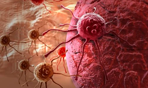 1 70771 original jpg jpeg