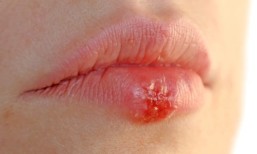 1 72377 original jpg jpeg