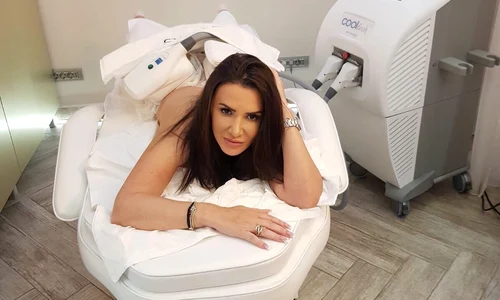 criolipoliza skin medspa jpeg
