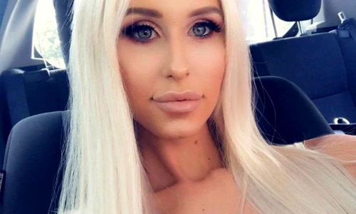 A trăit şase ani în agonie, din cauza implanturilor mamare  Silicoanele o "ucideau încet" jpeg