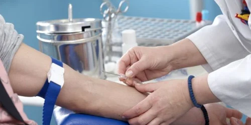 Riscul de cancer de prostată se poate evalua prin măsurarea nivelului antigenului specific prostatic din sânge 
