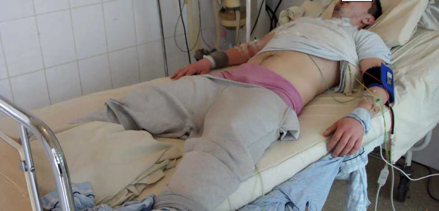 Tanarul aflat in insufiecienta multiorganica din cauza drogurilor