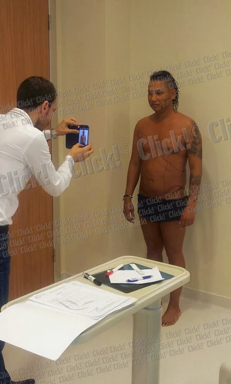 Adrian Pescariu şi-a făcut liposucţie în mai multe zone ale corpului.