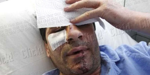 Stelian Ogică plăteşte acum bani grei pentru refacerea danturii