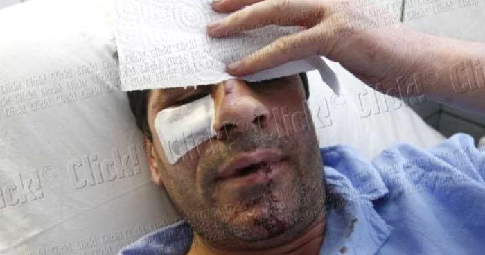 Stelian Ogică plăteşte acum bani grei pentru refacerea danturii