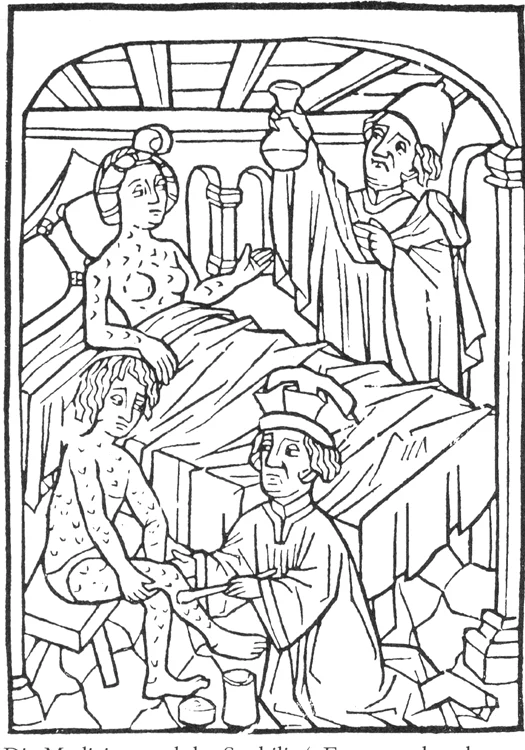 Cea mai veche ilustrație medicală cu privire la sifilis (Viena, 1498)