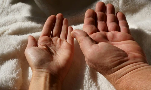 acromegalie gigantism jpg