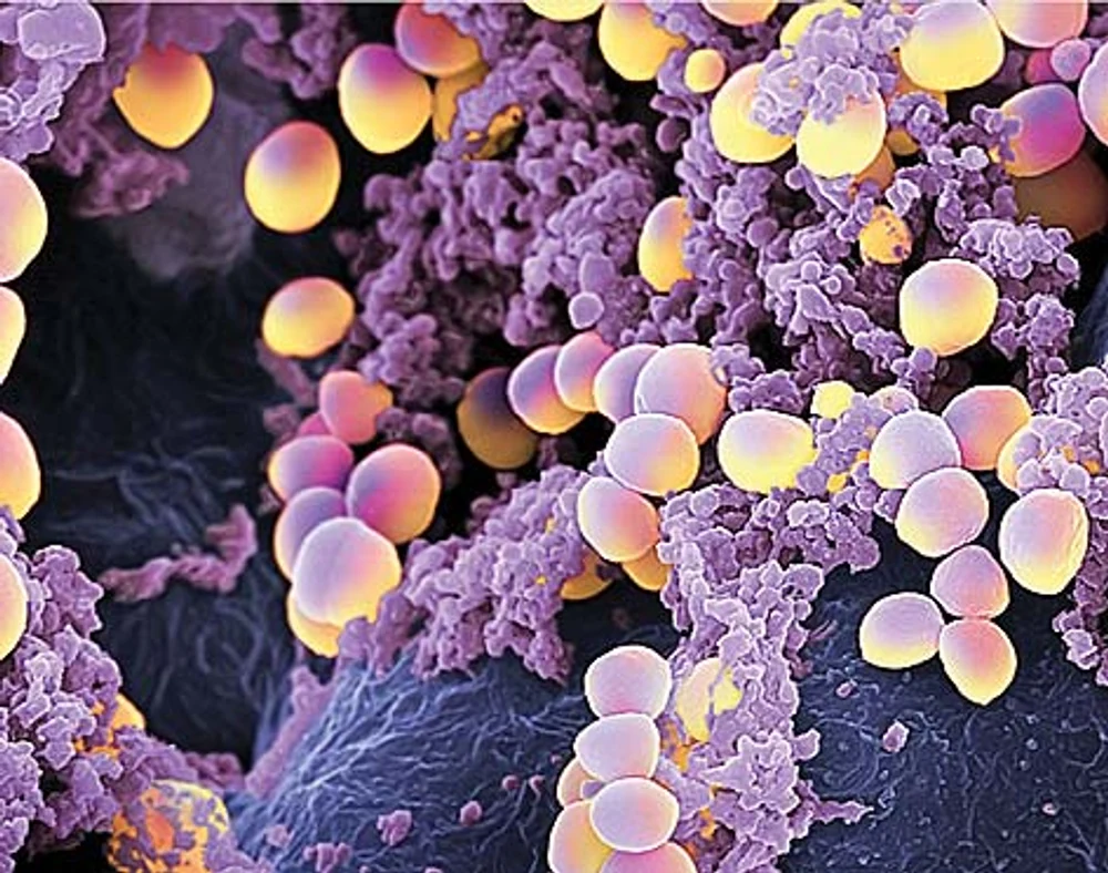 Medicii avertizează: Nu toți microbii identificați în nasul copiilor, inclusiv Stafilococul auriu, provoacă boli de sezon