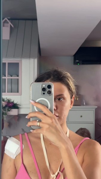 Imagini înfiorătoare cu Emily Burghelea după accidentul teribil din Mauritius. Vedeta are nevoie de mai multe operații FOTO VIDEO