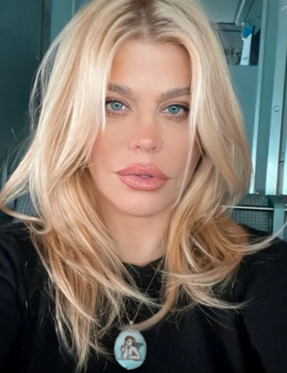 Loredana susține că nu are operații estetice