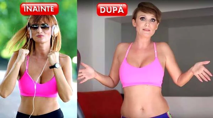
    Fashionista a pus grăsime în zona abdomenuluiFoto: ADPM   